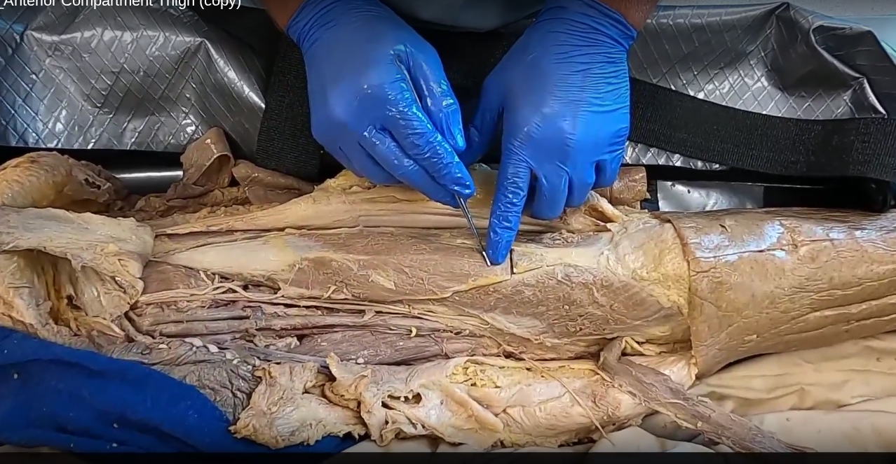 <ul><li><p>deep to sartorius</p></li><li><p>most superficial of quadraceps</p></li><li><p>attaches via quadraceps tendon</p></li></ul><p></p>