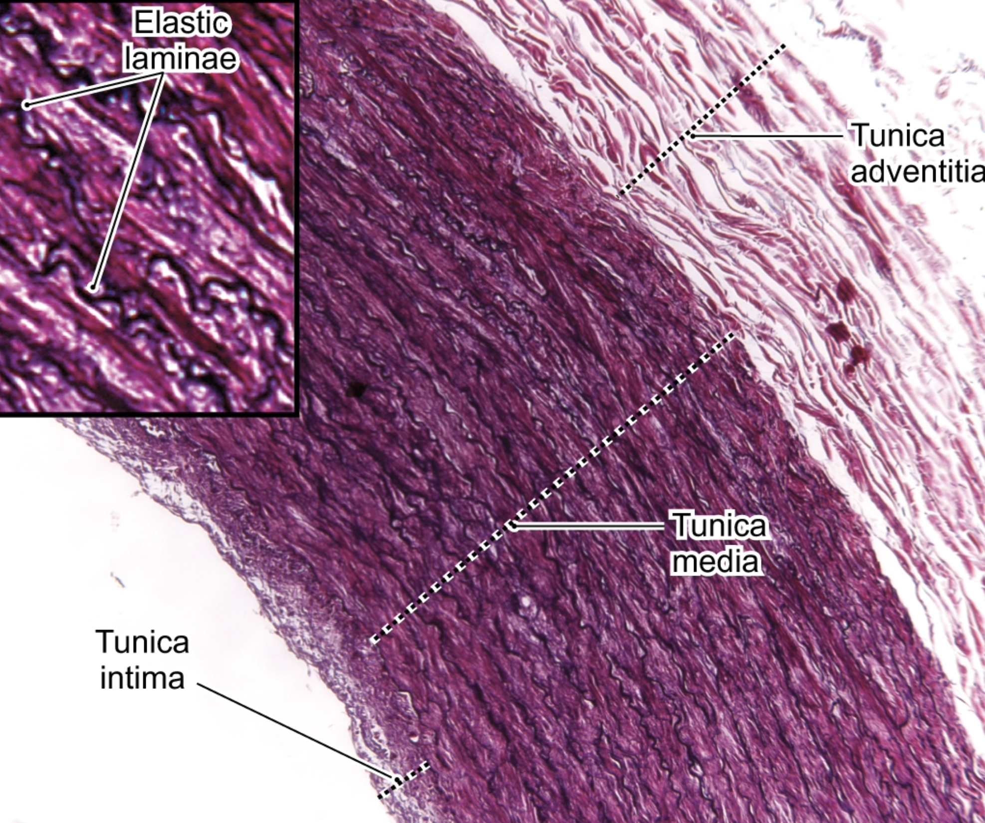 <p>large artery (elastic artery)</p>