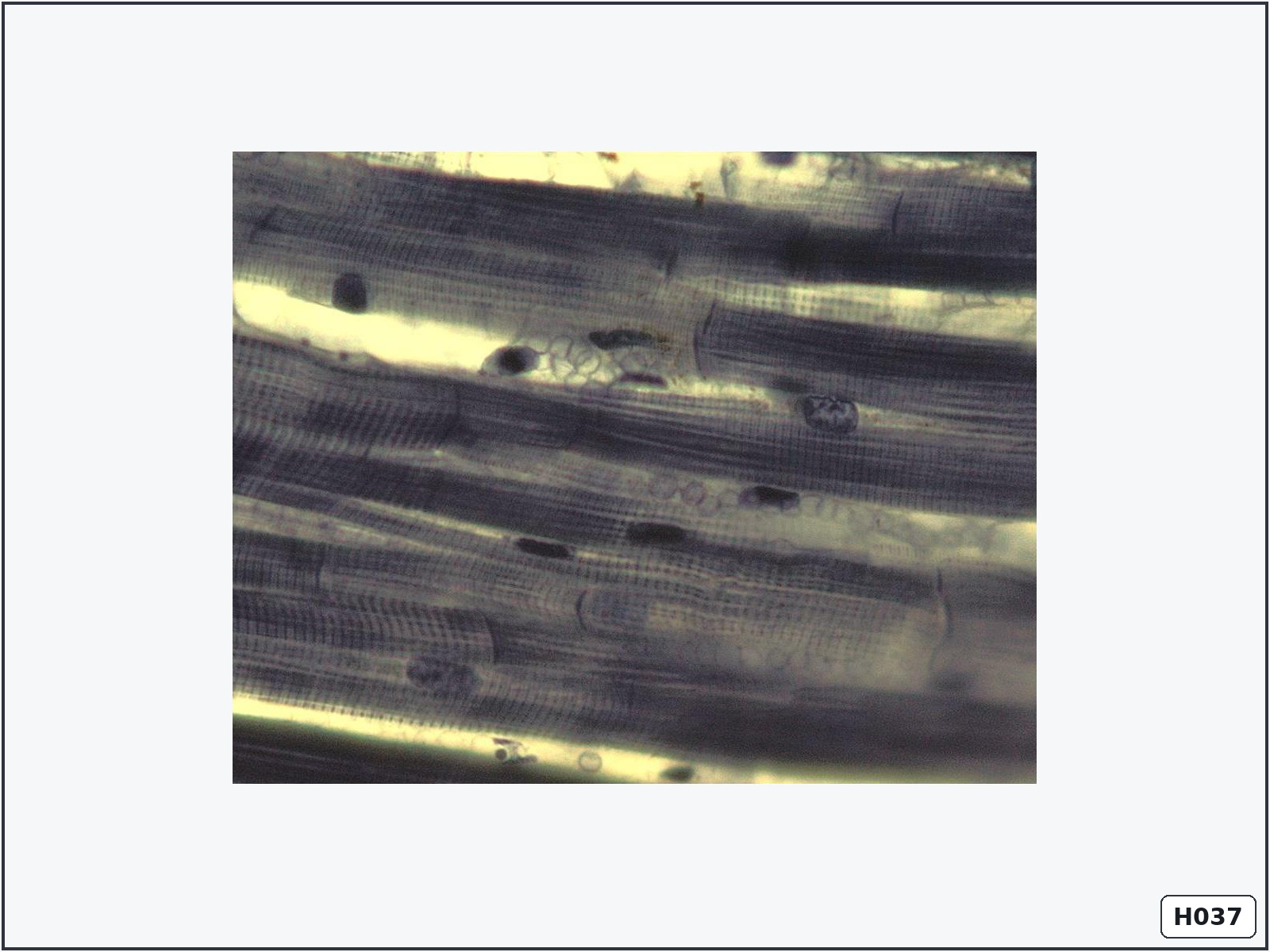 term image