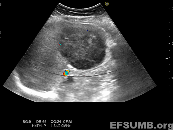 <p>What is this image demonstraating</p>