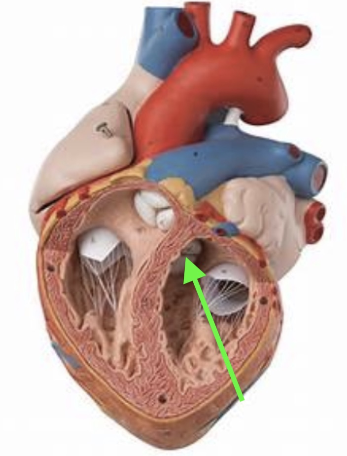 <p><strong>Identify the indicated valve.&nbsp;</strong></p>