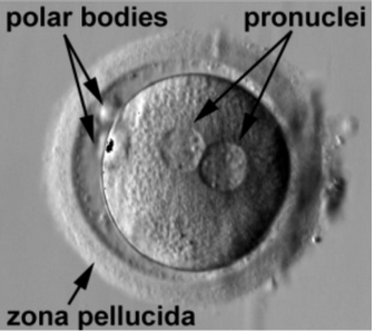<p>nuclear material remaining in ovum after occyte activation</p>
