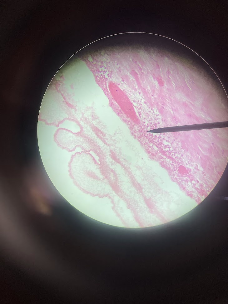 <p>structure name + layer name</p>