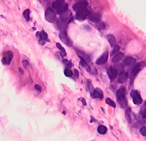 <p>soort epitheel</p>