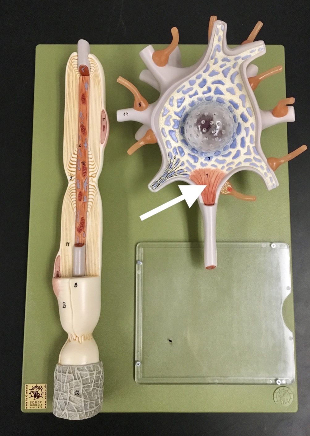 <p>What is the arrow pointing to?</p>