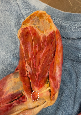 <p>Identify the muscle</p>