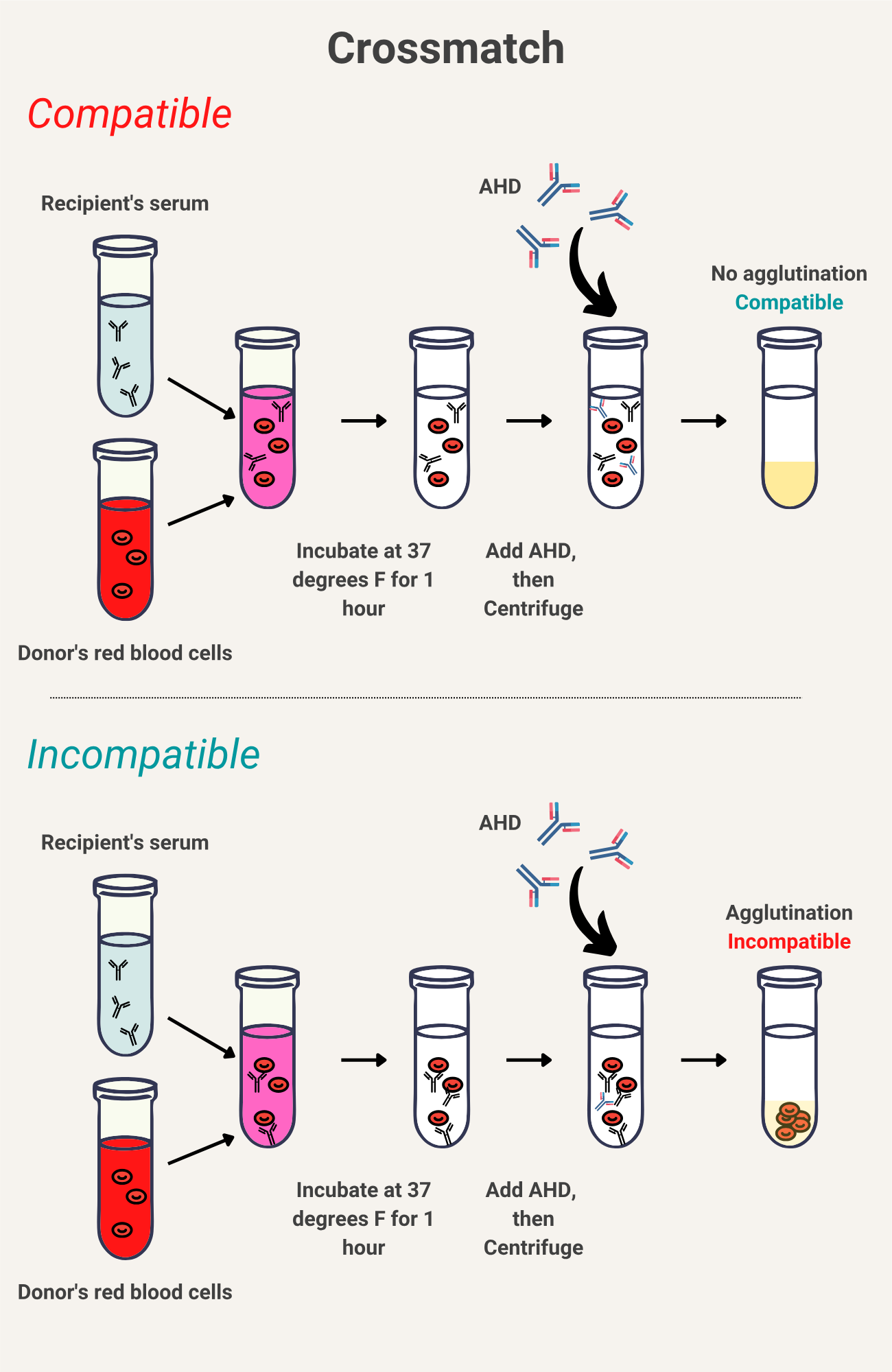 <p>test to determine/judge the compatibility between donor cells and recipient serum</p><p>Drop antisera A, B, D and recipient’s serum on clean palettes</p><p> • Drop the sample to be tested (donor blood) into each well</p><p> • Stir with different stirrers</p><p> • Observe after 60 seconds for agglutination</p>