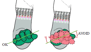 <ul><li><p>Pinky side palm slightly lower than thumb side</p></li><li><p>Wrist aligns with forearm</p></li></ul><p>Avoid</p><ul><li><p>Parallel hands</p></li><li><p>Wrist bent up or down</p></li></ul><p></p>