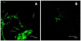 <p>Enzyme-Linked Immunofluorescence Assay (ELFA) via Solid Phase Receptacle (SPR)</p>