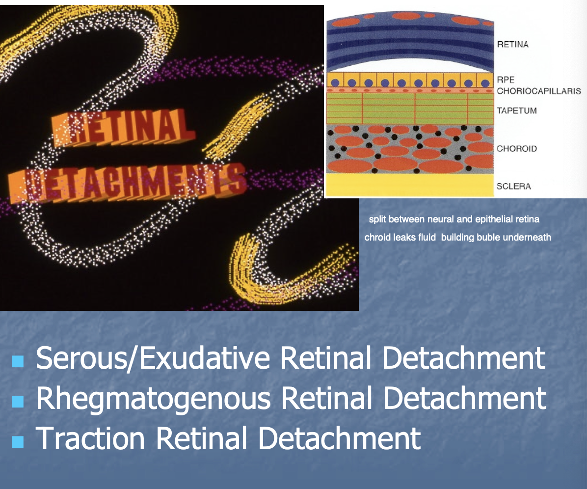 <p>Serous/Exudative.</p><p>Rhegmatogenous.</p><p>Traction.</p>