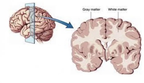 <ul><li><p>Cerebral cortex: the outer layer of grey matter</p></li><li><p>Cerebral white matter: below the grey matter.</p></li></ul><p></p>