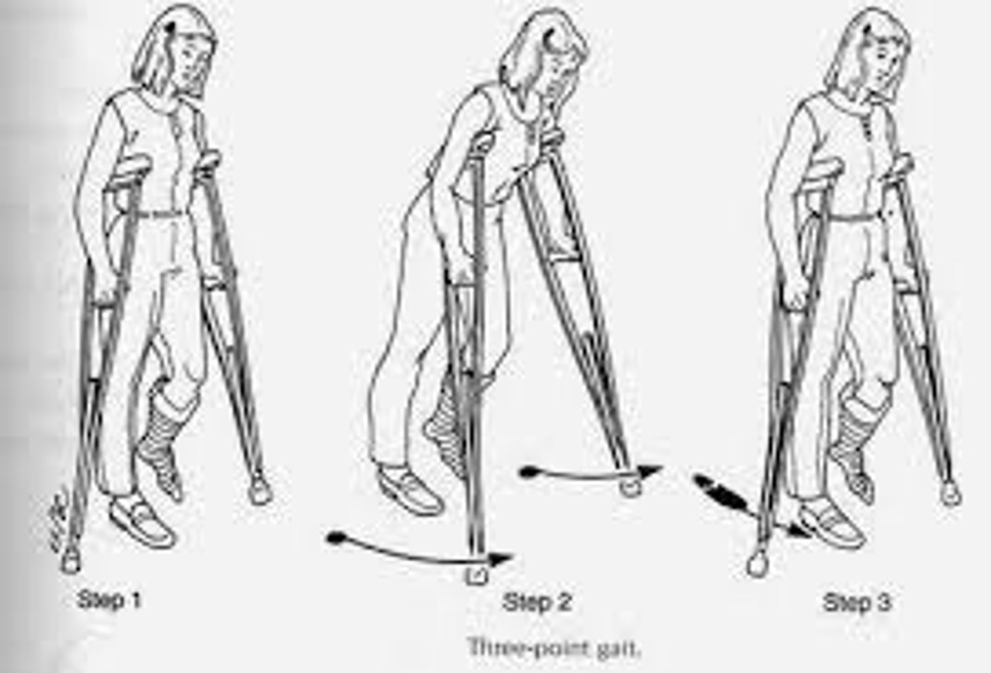 <p>three points of contact; AD is advanced followed by limited LE then stronger LE</p>