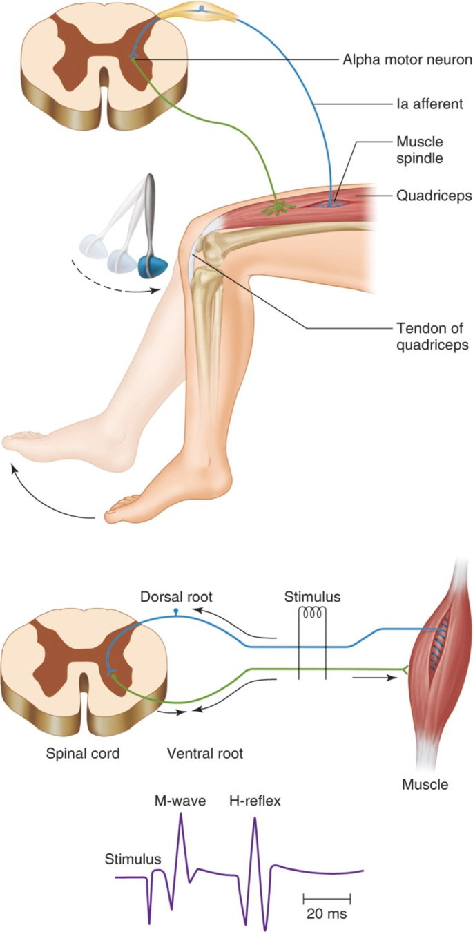 <p><span>Begge bruger hovedsageligt den samme </span><strong>Ia-afferent → α-motorneuron</strong><span> refleksbane. T-refleksen udløses ved et </span><strong>mekanisk stræk</strong><span> (reflekshammer), mens H-refleksen udløses ved </span><strong>elektrisk stimulation af nerven</strong><span>. Begge registreres typisk med </span><strong>EMG</strong><span>.</span></p>