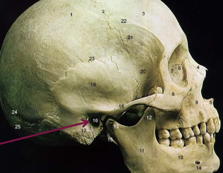 <p>what is the arrow pointing to</p>