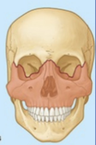 <p>What type of fracture?</p>