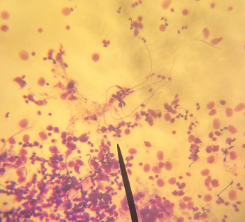 <p>What are these?</p>