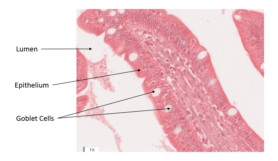 <p>Jejenum</p>