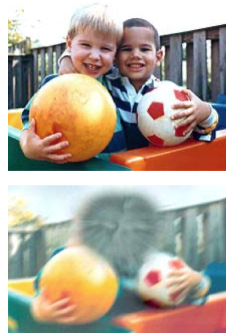 <p><strong>AMD, aldersrelateret macula degeneration</strong>, er en sygdom i <strong>macula</strong>, som giver <strong>progressivt tab af det centrale syn</strong>.</p>