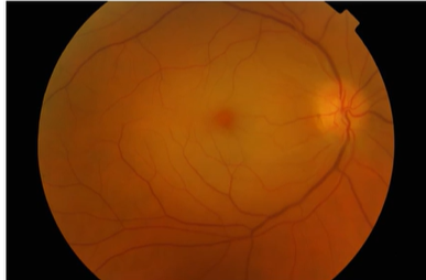 <p>Name the condition </p>