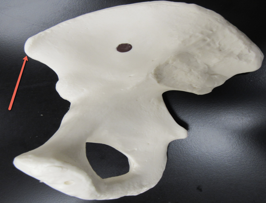 <p><strong>Identify the bone marking indicated by the pointer.</strong></p>