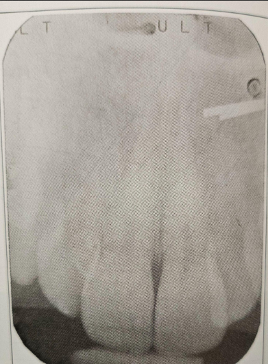 <p>Film Artifact</p>