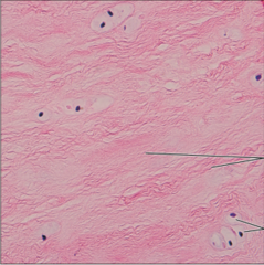 <p>name the tissue: amorphous but less firm matrix; thick collagen fibers predominate</p>