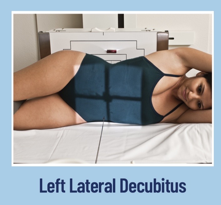 <p>the patient will be lying on their left side with the bucky behind them; the CR will be horizontal with the patient; the lead marker will mark the R side as that is the elevated side.</p>