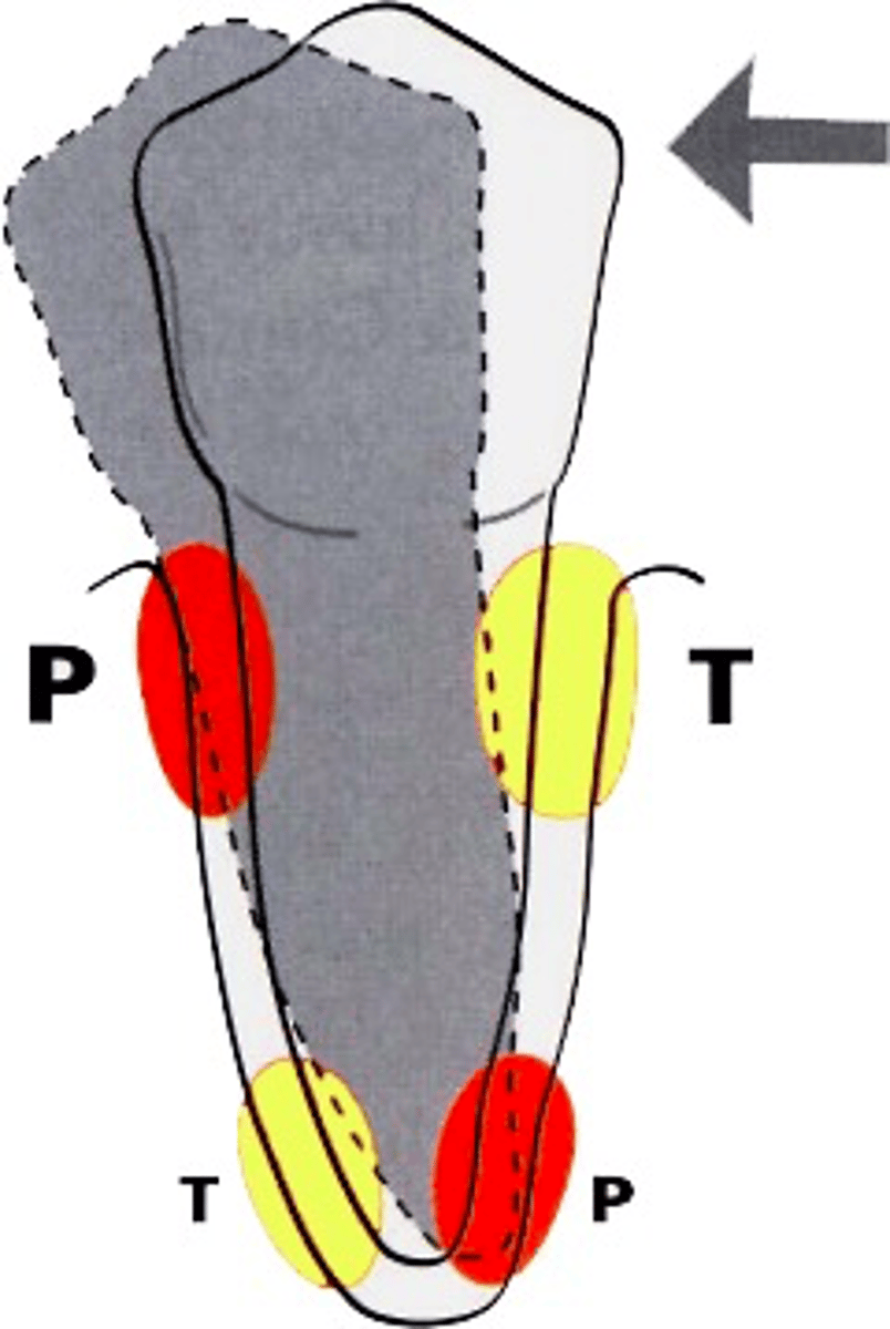 <p>What is movement of the tooth while the apex moves in the opposite direction?</p>