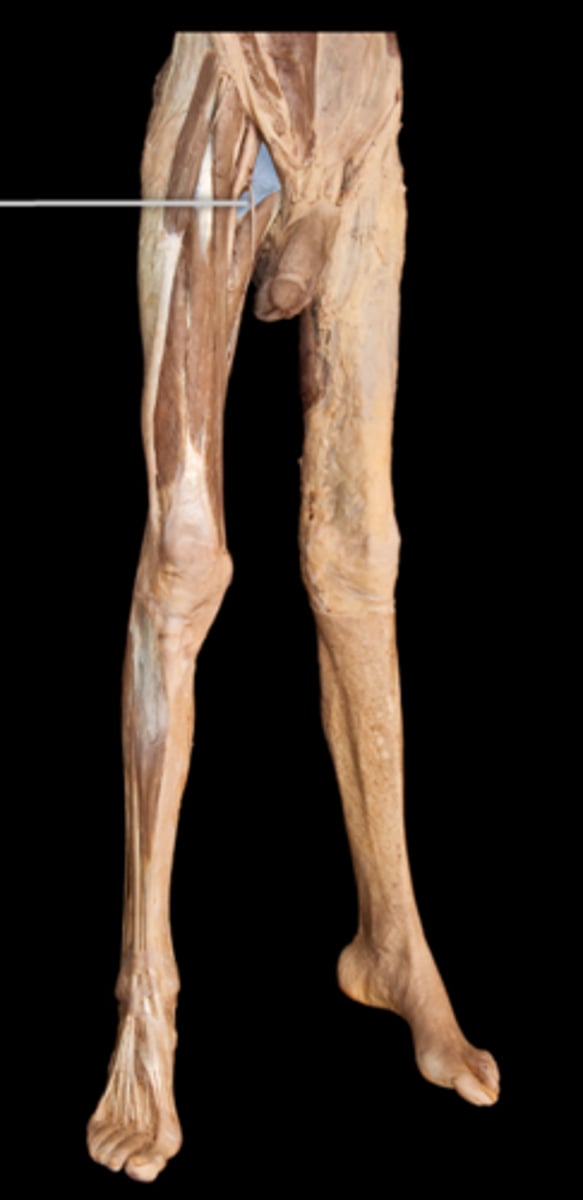 <p>What muscle is this?</p>