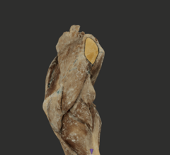 <p>What muscle is highlighted in the picture?</p>