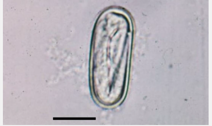 <p>What features on this egg help identify it as <span style="color: blue;"><em>Spirocerca lupi</em>?</span></p>