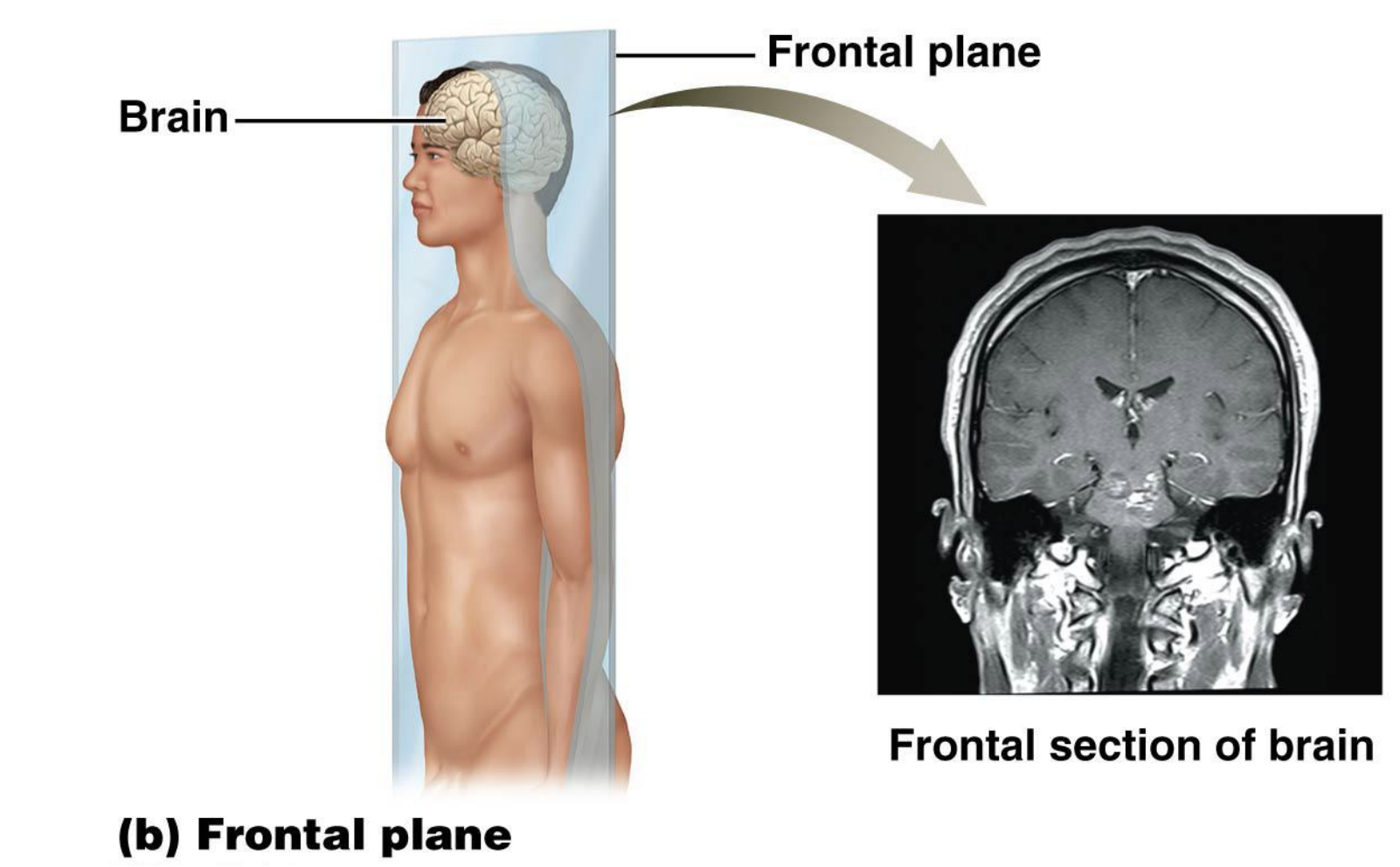 <p>Divides body or body part into anterior and posterior sections</p>