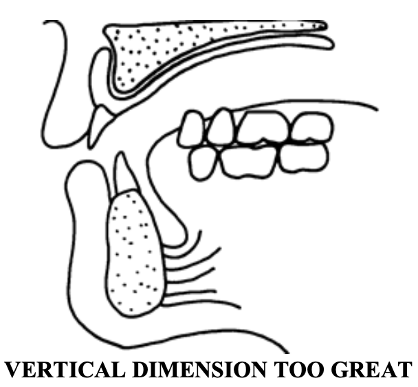 <p>Speech problems help the doc identify tooth-positioning errors. What if the VDO is too great?</p>