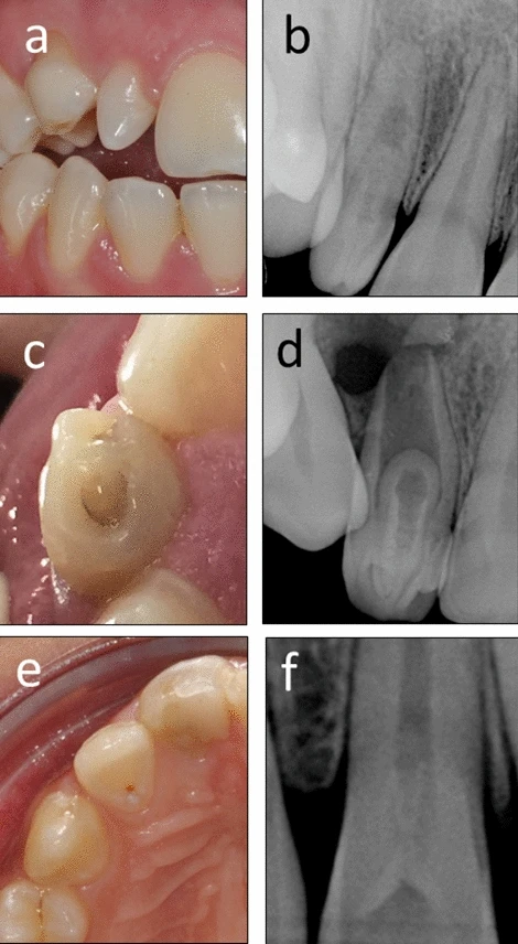<p>What abnormality is this?</p>