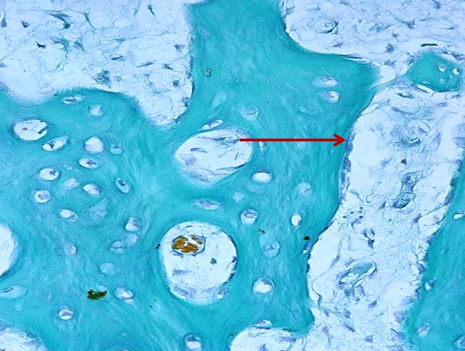 <p>Tế bào gì ?</p>