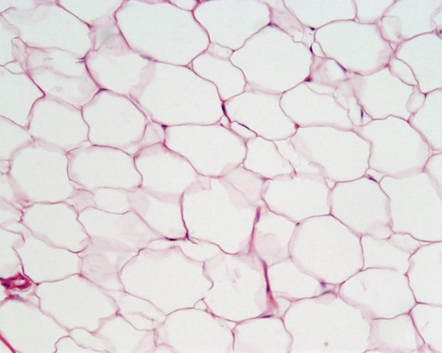<p>Adipose Connective Tissue</p>