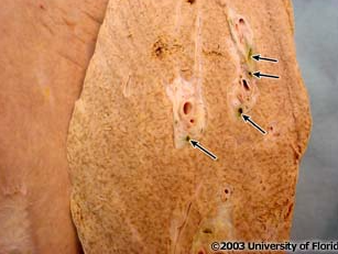 <p>what structure is noted on the inside of the liver?</p>