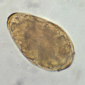 <p>Oriental lung fluke? Big ahh egg? Has shoulders and operculated? </p>