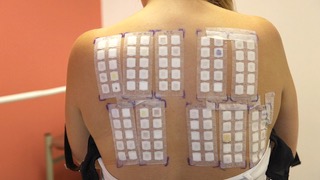 <p>The most common method for testing contact allergens is through patch testing, where small amounts of allergens are applied to the skin under patches to observe for allergic reactions. </p>