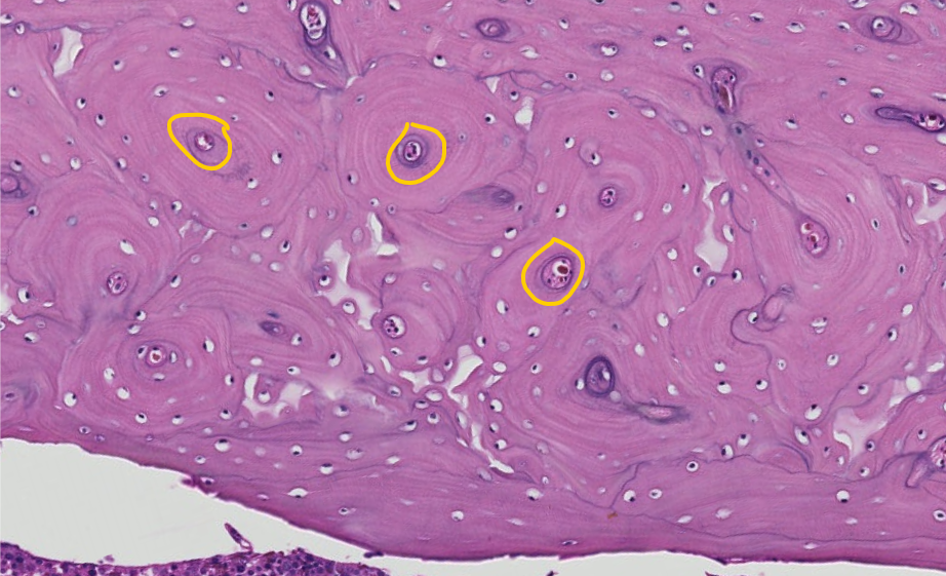 <p><span style="font-family: "Calibri Light";">This is the diaphysis (shaft) of a long bone in transverse (cross) section. <br>ID the encircled region of the osteon.</span></p>