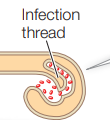 <p>a tubular, tunnel-like structure formed by a plant cell during its symbiotic relationship with nitrogen-fixing bacteria. it acts as a safe pathway that allows the microbes to travel deep inside the plant’s root to form nodules.</p>