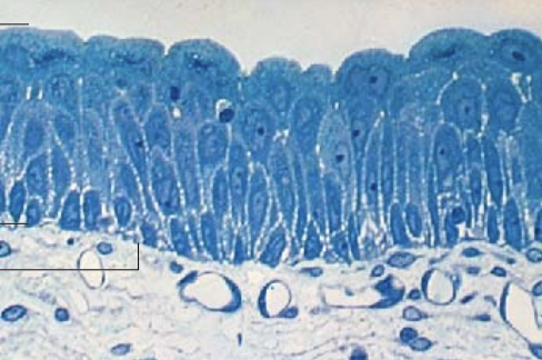 <p>what epithelial tissue is this? what are its functions? What distinguishes it structurally? where is it in the body?</p>