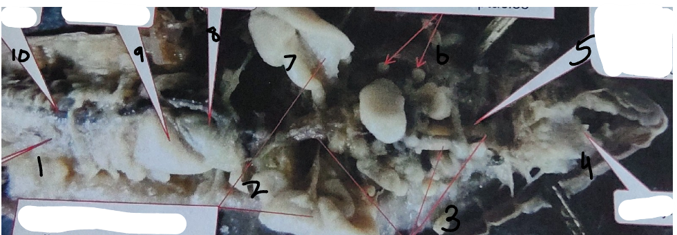 <p>What is point 4 on this earthworm</p>