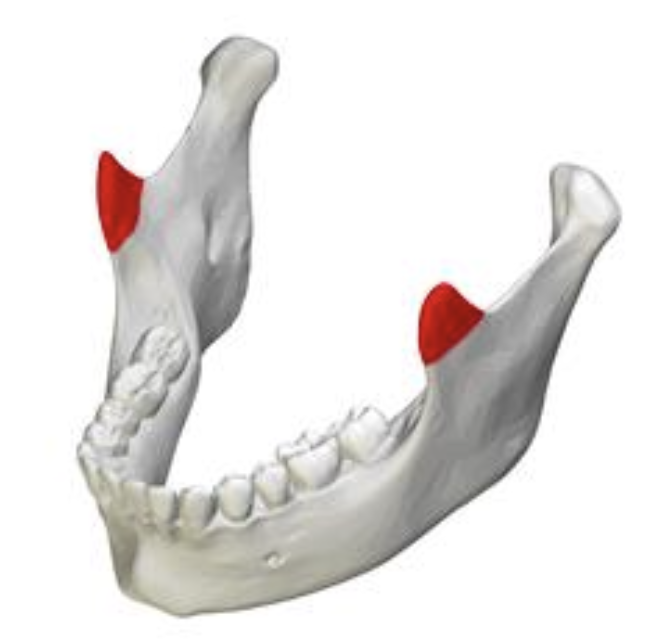 <p>Name the part of the mandible shown in red in the figure provided.</p><p>A. Condyle </p><p>B. Coronoid process </p><p>C. Ramus </p><p>D. Angle</p>