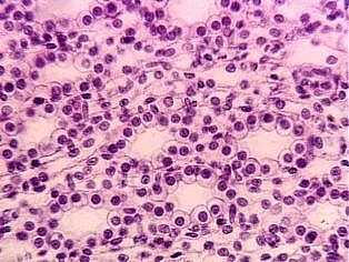 <p><span>Simple cuboidal epithelium</span></p>