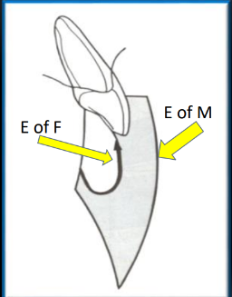 <p>-merely recording the outer limits of motion (EoM) would not supply the needed information for restoration of anterior teeth</p><p>-also need EoF</p><p>-EoF that controls the anterior relationship must be treated as a separate entity</p><p>-it must be recorded in the mouth, no articulator setting can produce it</p><p>-an articulator can <u>re</u>produce it</p><p>-prepare the tooth, put temp crown on, see how it works in the mouth- pt will tell you based on feeling</p>