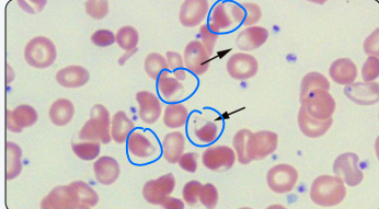 <p>blister cell (hemighost)</p>