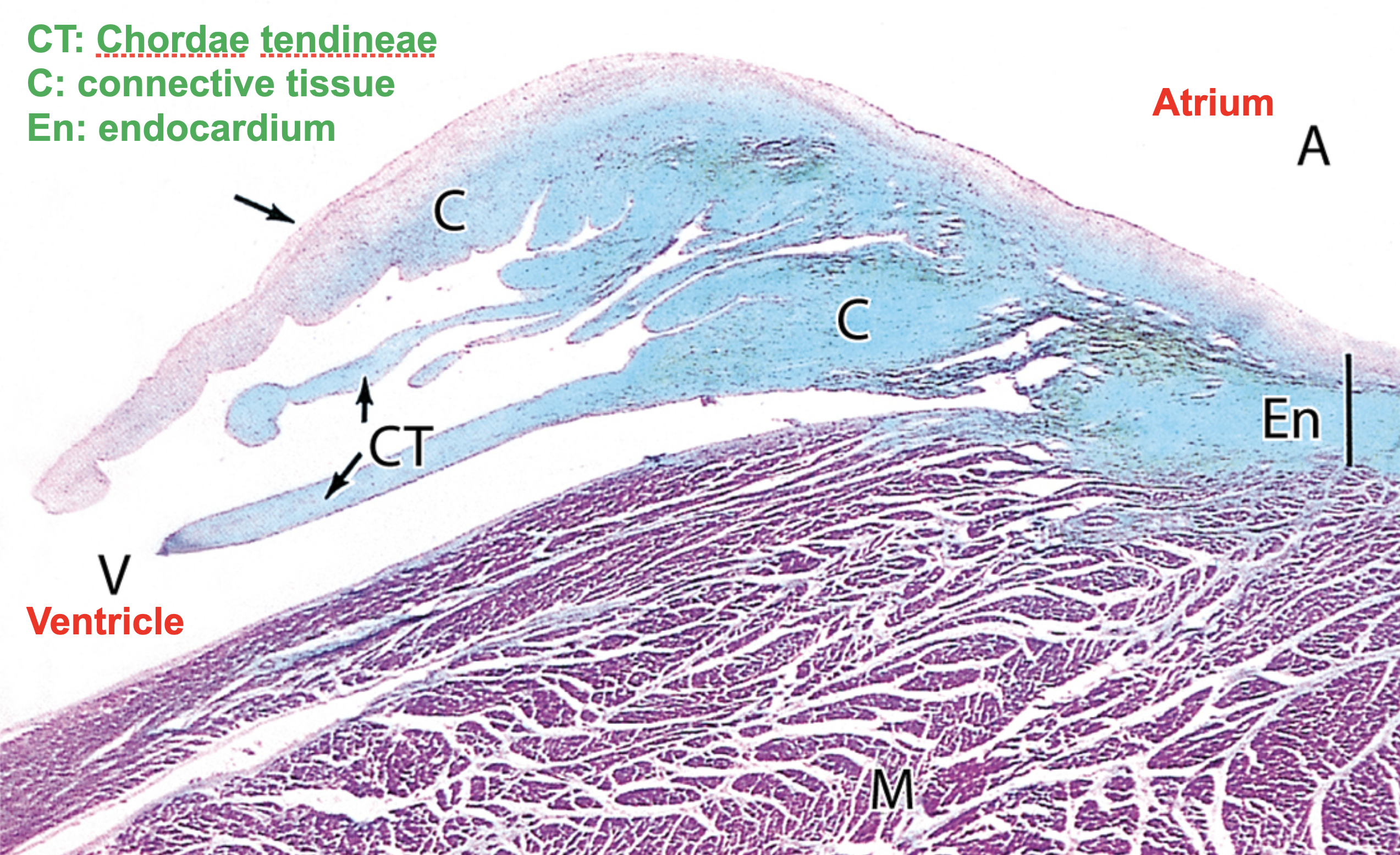 <p>endocardium</p>