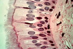 <p>Single layer but some cells shorter than others, often looks like a double layer</p>