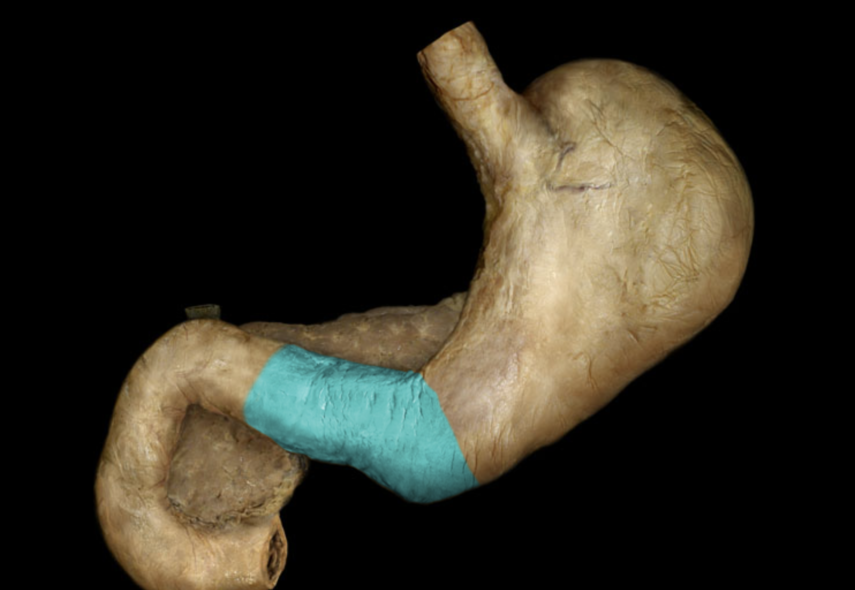 term image
